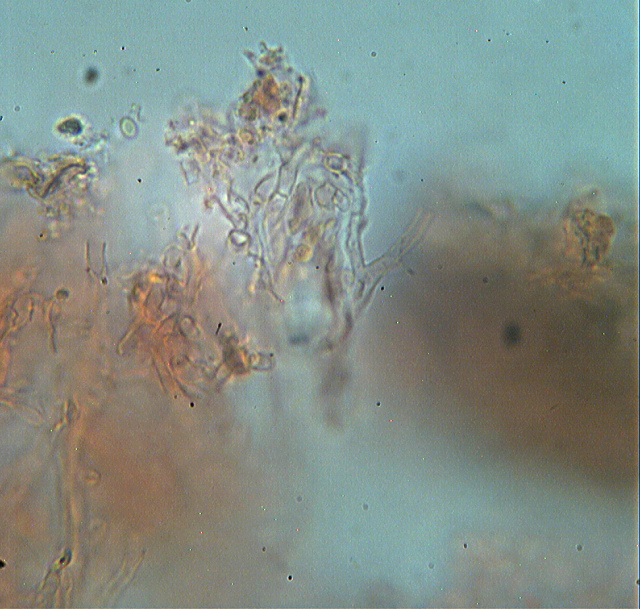 Thanatephorus sterigmaticus. Trovato da Paolofon